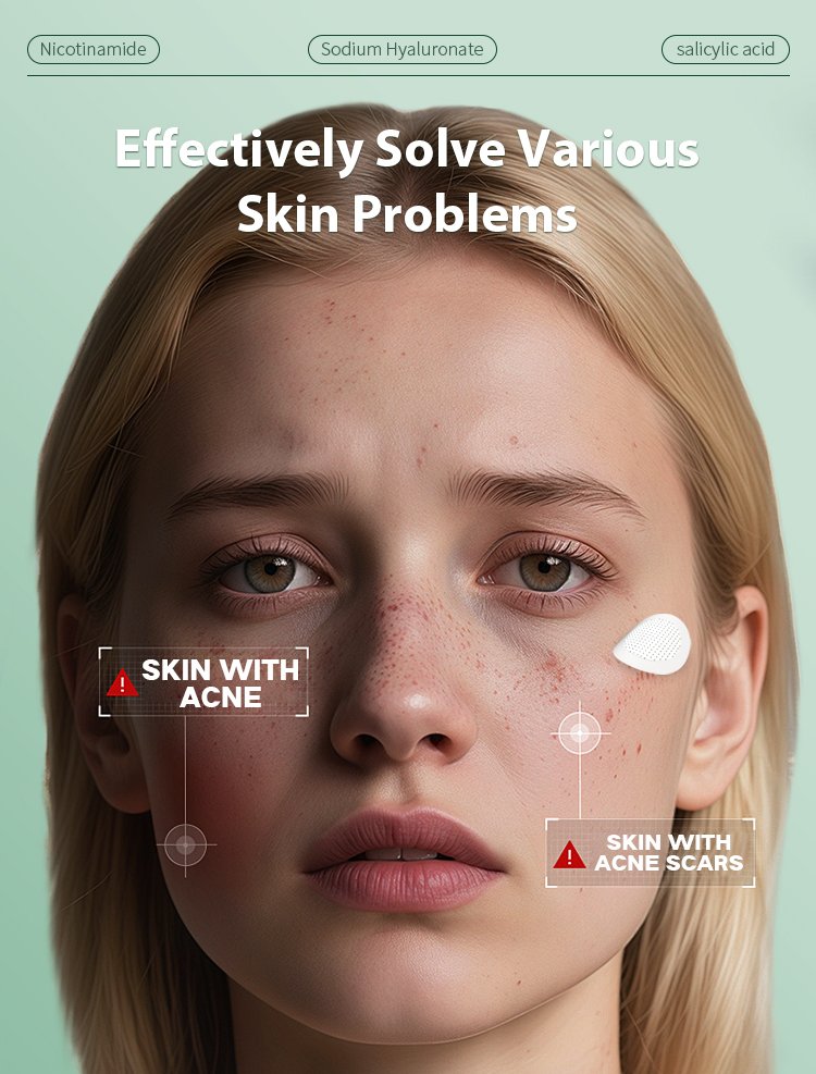 Private Label Microdart Acne Patch - Image 2