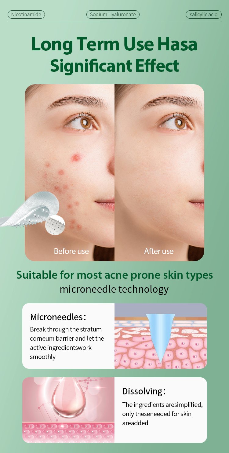 Private Label Microdart Acne Patch - Image 3