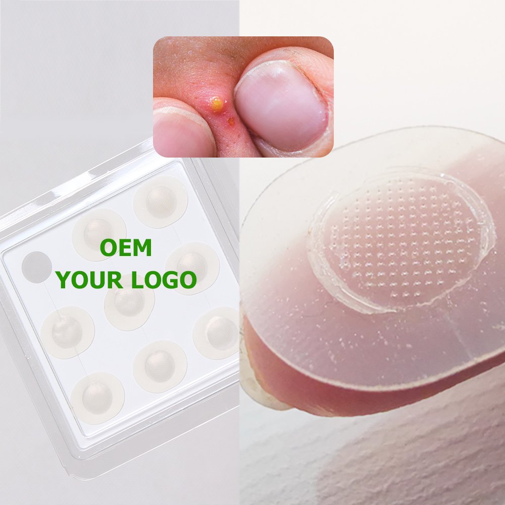 Private Label Microdart Acne Patch - Image 4