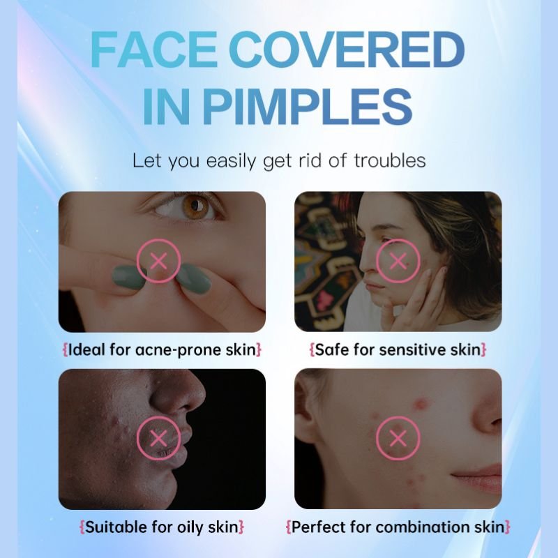 Star Healing Hydrocolloid Acne Patch - Image 2